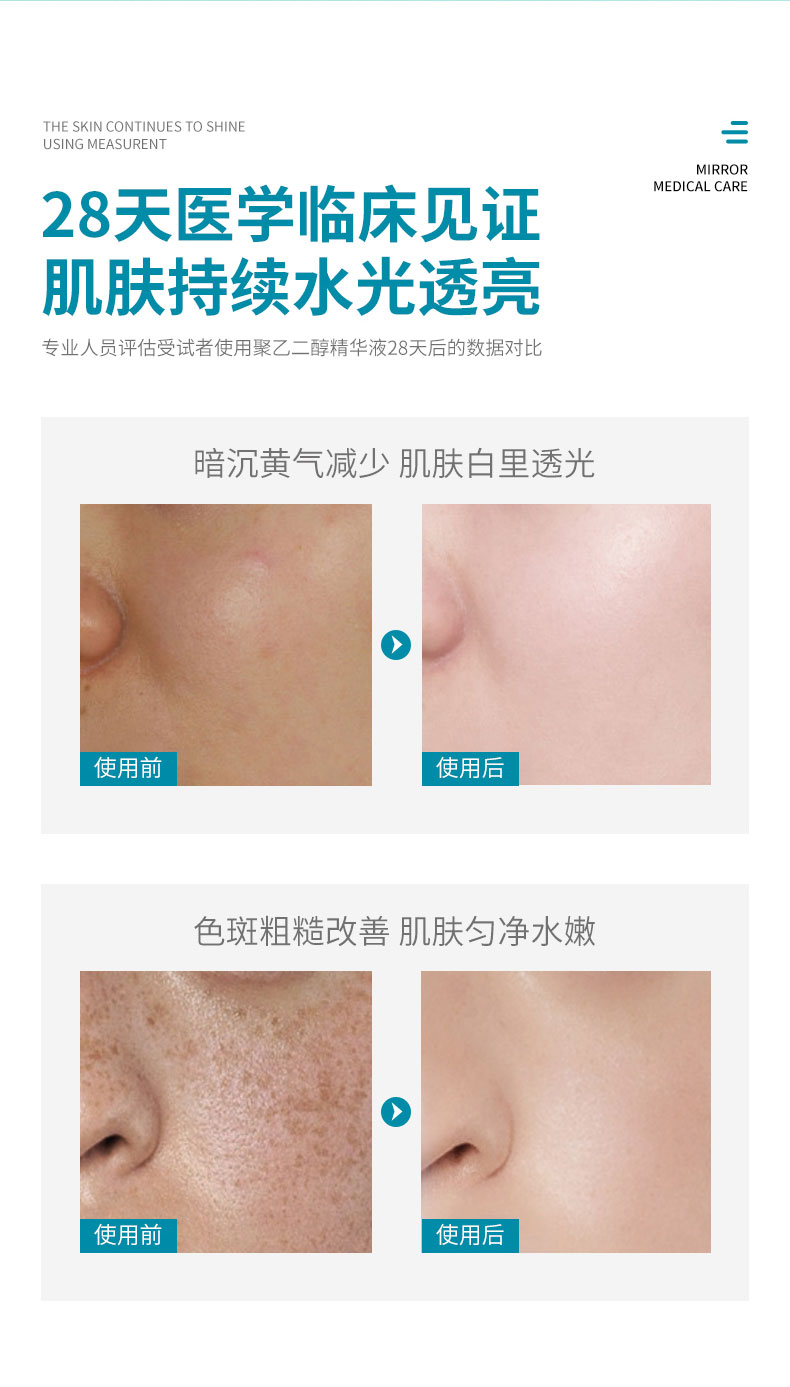 BP-聚乙二醇液体敷料-小水库-详情页_06.jpg
