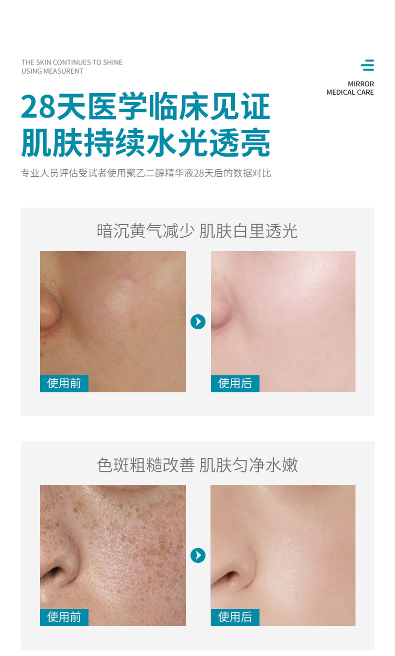 BP-聚乙二醇液体敷料-小喷泉-详情页_10.jpg